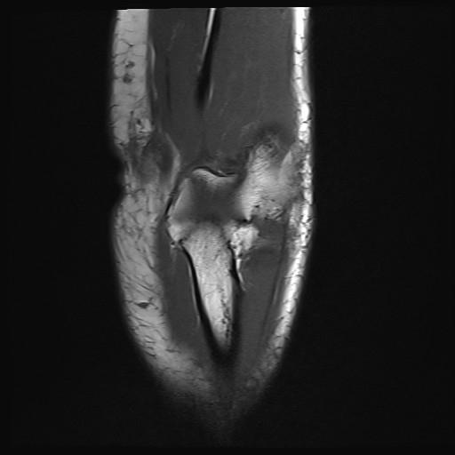 Click on the Serie image to view the images of Wieszt, Gnter